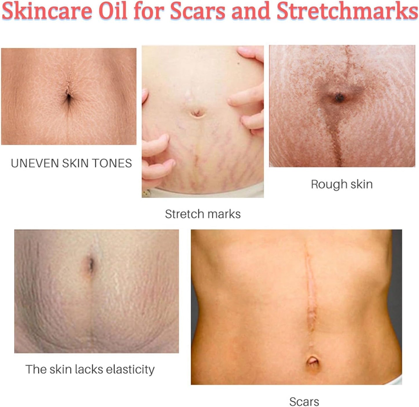 Stretch Mark Pregnancy Massage Oil, Stretch Mark Oil, Skincare Oil for Improve Stretchmarks, Pregnancy Skin Care Fade Stretch Marks, Body Moisturizer for Dry Skin, First Time Mom Gift 30 ml